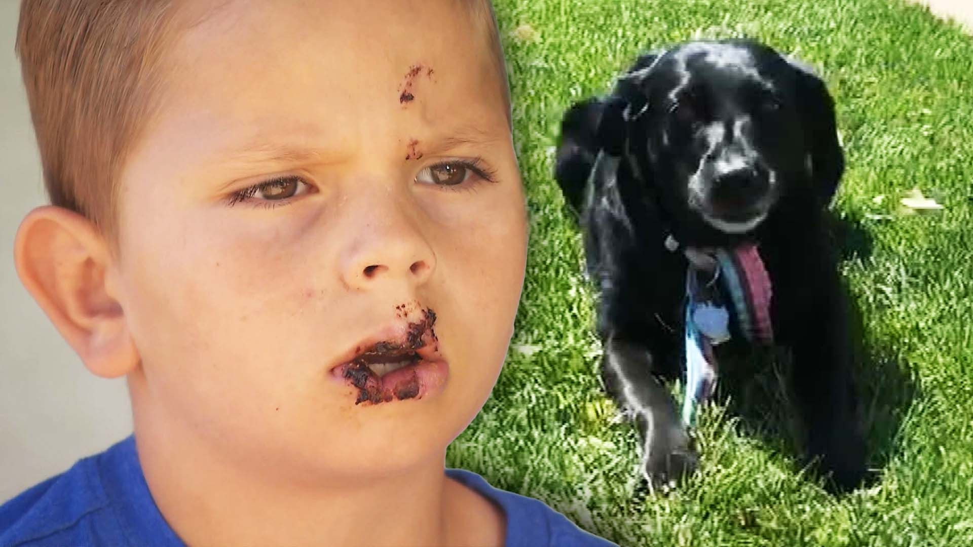 what to do if a dog attacks a child